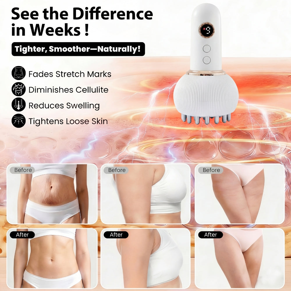 Thermo‑Pulse™ Cellulite & Lymphatic Drainage Massager