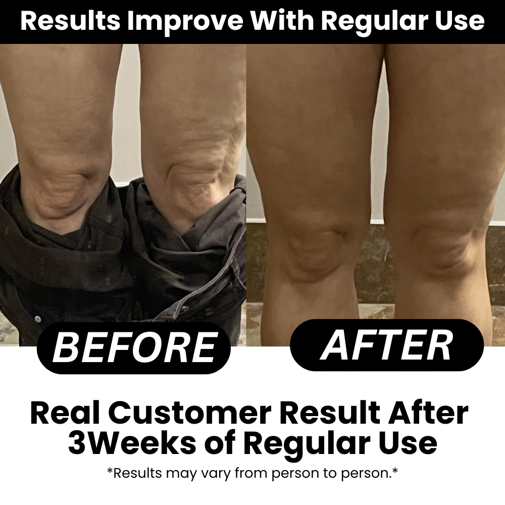 NovaPureHealth™ - Anti-cellulite Massage Oil