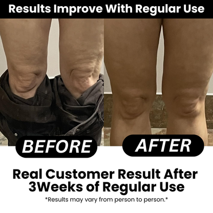 NovaPureHealth™ - Anti-cellulite Massage Oil